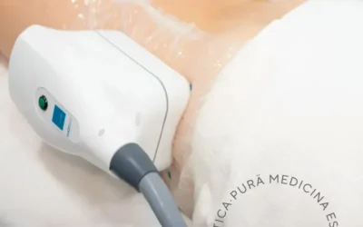 Descubre la Eficiencia de la Criolipólisis en Málaga con Grupo NEVA Tecnología Estética